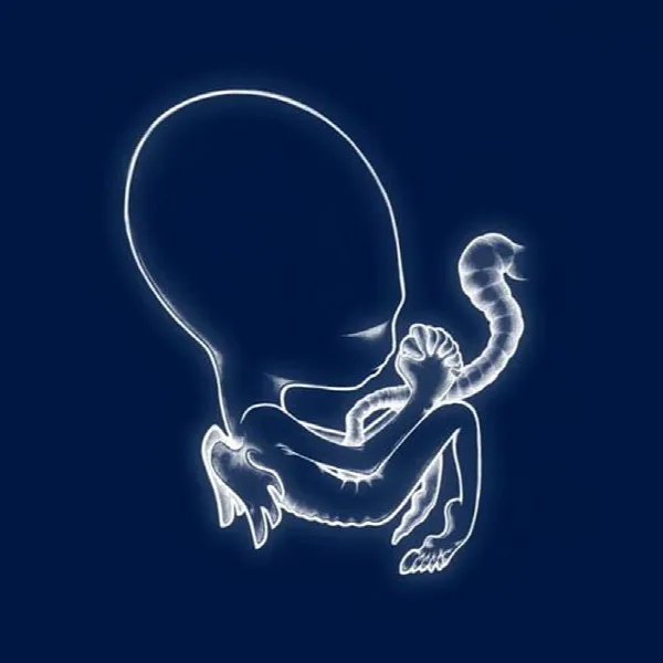 Pochette de Ágætis byrjun